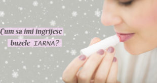 cum-sa-imi-ingrijesc-buzele-iarna