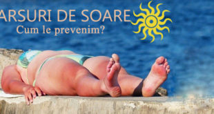 Arsuri de soare -cum le prevenim? - Body & Skin